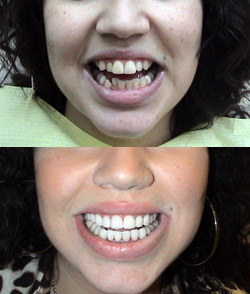 Before & After