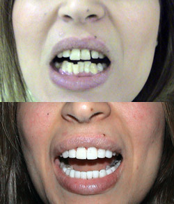 Before & After