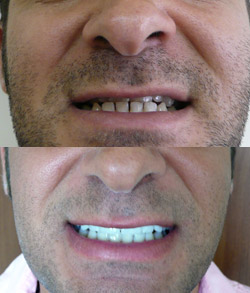 Before & After